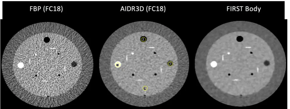 Figure 6. Catphan reconstructed with FBP, AIDR3D and FIRST. Four ROI (yellow circles) were selected to compute the MTF