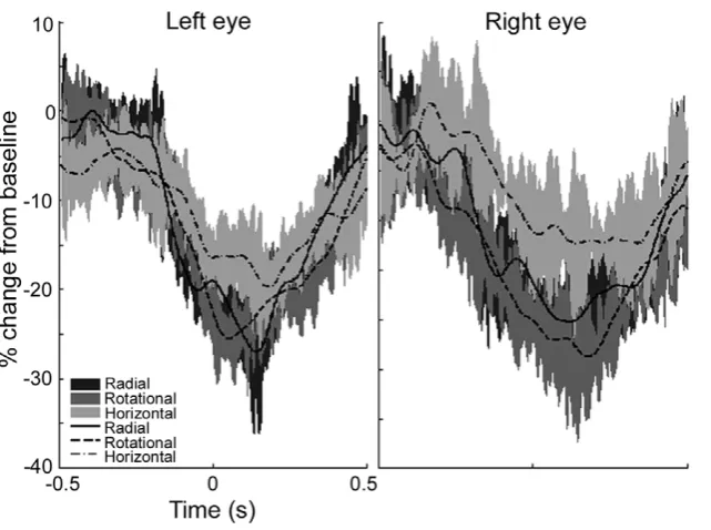 Figure 6. Mean (n = 5) time-frequency plots. Mean (n = 5) time-frequency plots are shown for virtual electrodes placed at the location ofmaximal power change as determined using SAM (10–20 Hz, 1 s time windows)
