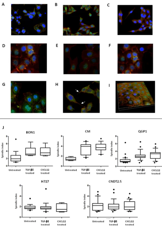 Figure 4: CXCL12 induces modifications in NET cell morphology.  Changes in NET cell morphology upon CXCL12 or TGF-β1  stimulation were assessed by confocal microscopy