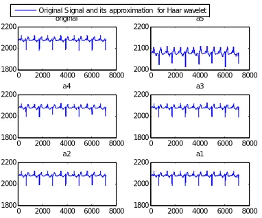 Figure 8.1 Original ECG signal  and its approximations using bd6 wavelet 