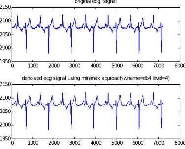 Figure 8.4  Original ECG signal  and its denoised version using Doubechie 6 wavelet for alpha=2 and decomposition level 4 using Birge Techique 