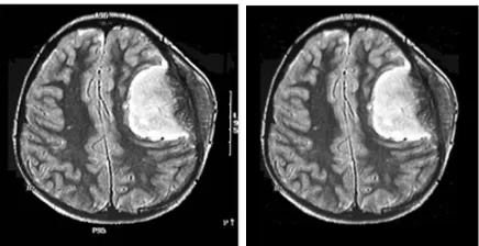 Fig 3: (a)  Image with Text Noise (original)  (b) Image without Text Noise (result) 