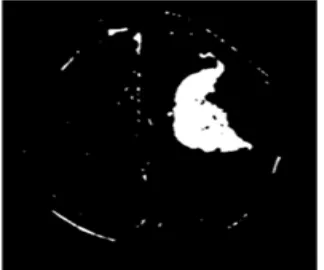 Fig 5. Segmentation Image (result) 