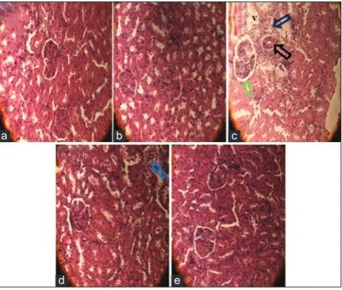 Table 7: Semi-quantitative recording of architectural damage on histopathological analysis of the kidney of control and treated rats