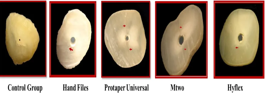 Figure 3. Stereomicroscopic images showing dentinal defects in different groups.