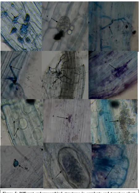 Figure 5: Different endomycorrhizal structures in eggplants and tomatoes plants inoculated with mycorrhizae