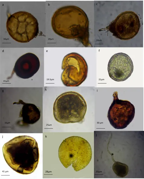 Figure 6. Endomycorrhizal species isolated from the rhizosphere of eggplant and tomato plants treated with mycorrhizae