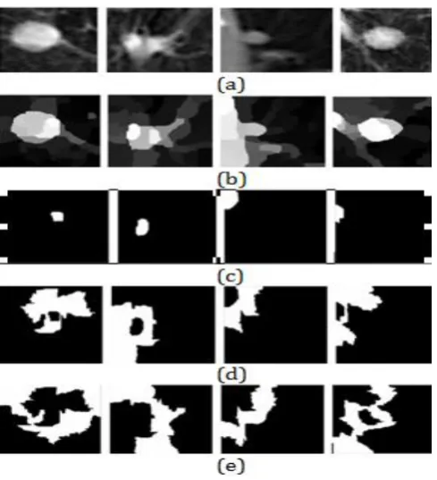 Fig -3: Procedure for the superpixel formulation scheme 