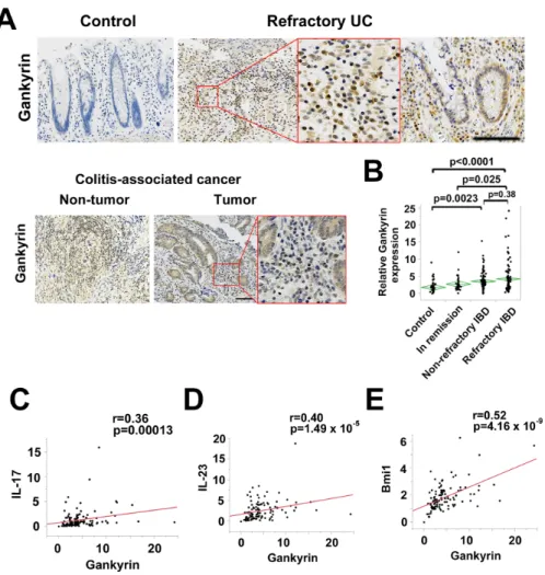 Figure 1: Gankyrin expression is increased in the colonic mucosa of patients with refractory IBD