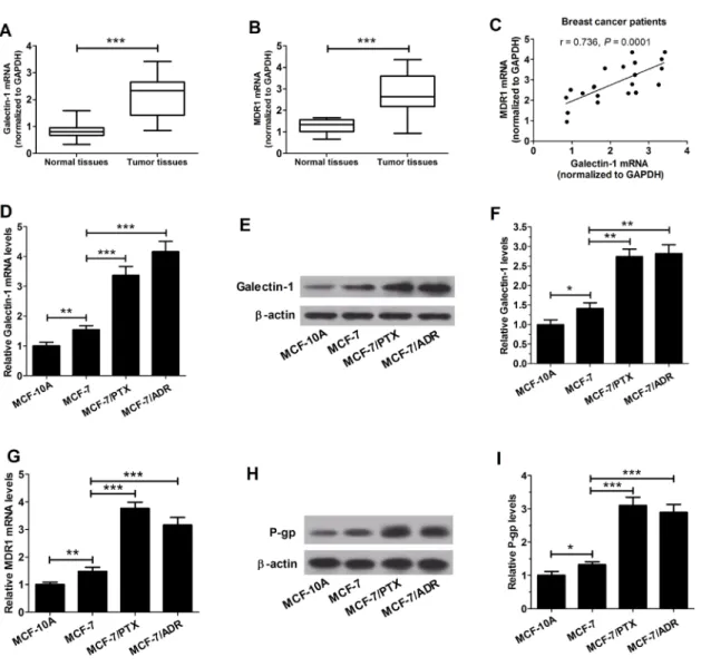 Figure 1: Expression of Gal-1 and MDR1 in breast tumor tissues and cells lines. A. qRT-PCR was used to measure the level  of Gal-1 mRNA (A) and MDR1 mRNA  B