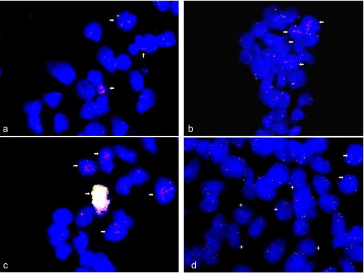 Figure 6: Gene amplification and under-replication in spontaneous and neural differentiation induced human neural  stem cells