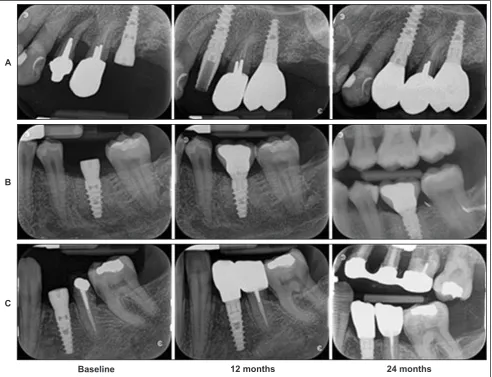 Table 2. Mean radiographic crestal bone loss and changes between groups and time periods according to implants placed (6 mm or 10 mm in length) (Mean [SD]; 95% CI)