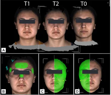 Table 1. Changes in swelling from T0 to T1 from T0 to T2