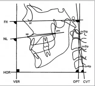 Table 2. Significant associations between pharyngeal airway dimensions and head posture adjusted for age and gender in the total group (n = 53)