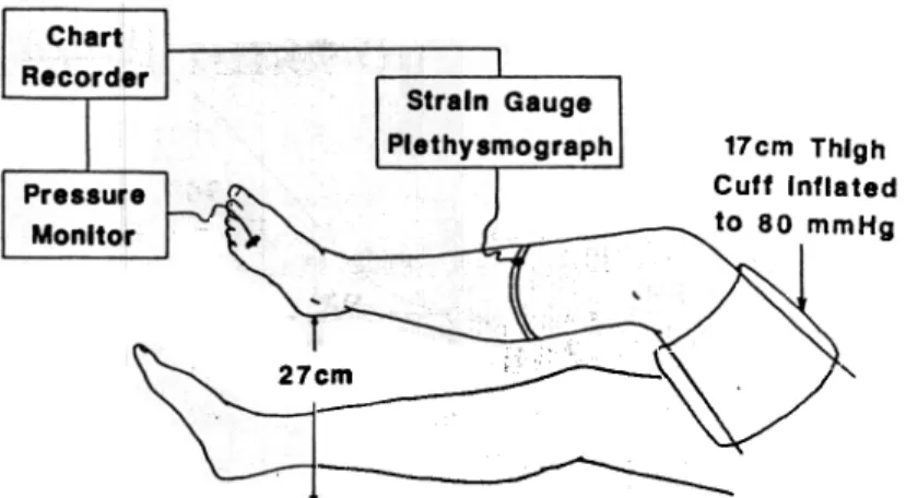 Fig.  2. Simultaneous  measurement  of pressure  and volume with  proximal occlusion.