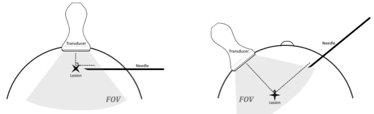Figure 3.10: Left: Needle insertion with respect to the ultrasound probe for shallow lesion targeting.Right: Needle insertion with respect to the ultrasound probe for deep lesion targeting.