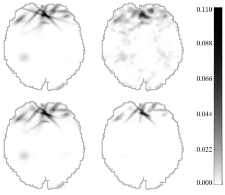 Figure 5: Activation estimates for the visual stimulation data. T op: Mean posterior activation