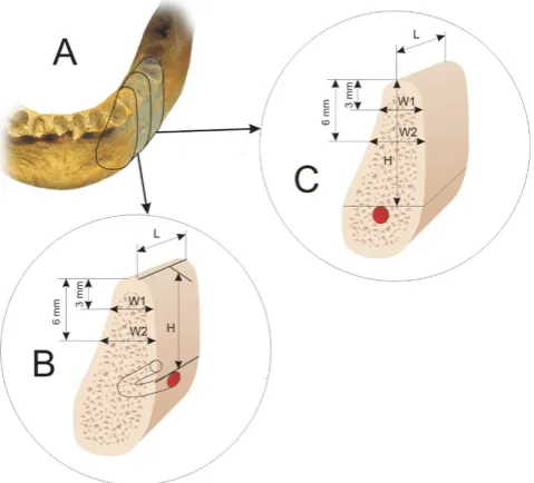 Figure 1. A = mandible is divided into edentulous jaw segments that consists of alveolar and basal bone for planned implant bed.B = the vertical dimension (H) of the planned implant is determined by the distance between the alveolar ridge crest and mental 