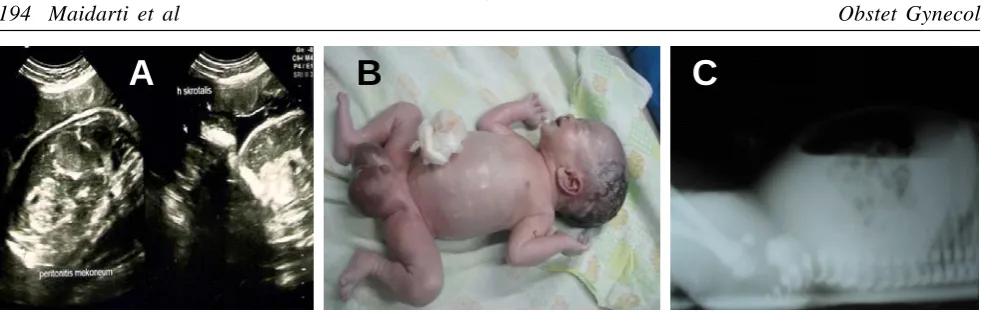 Table 1. Etiology of meconium peritonitis.11
