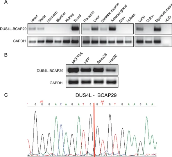 Figure 1: Detection of DUS4L-BCAP29 in non-cancer human tissues and cell lines.  (A) Detection of the DUS4L-BCAP29 in  several non-cancer human tissues by RT-PCR and followed by agarose electrophoresis