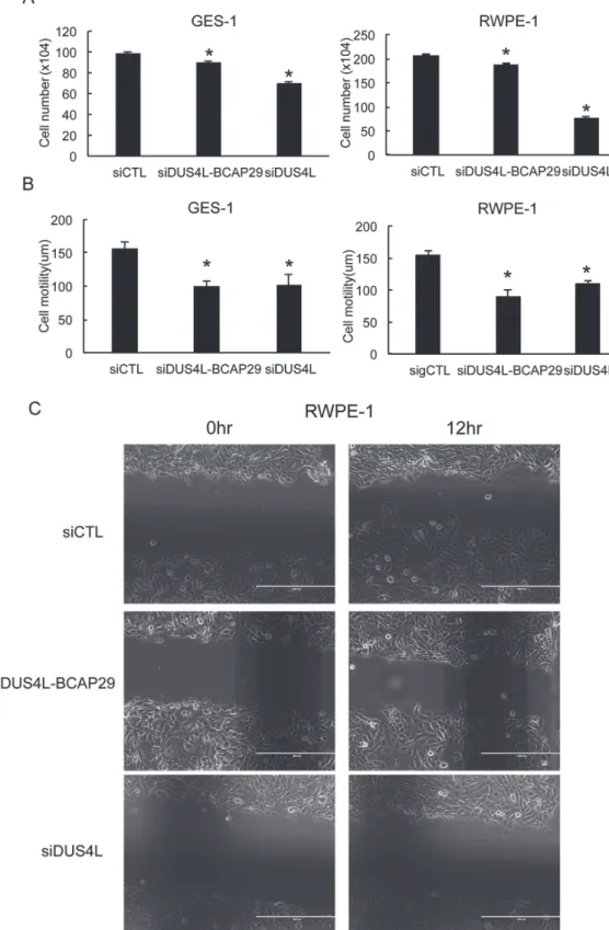 Figure 3: Loss-of-function system.  (A) siRNAs silencing DUS4L-BCAP29 and wild type DUS4L decreased cell proliferation in GES-1   and RWPE-1 cell lines