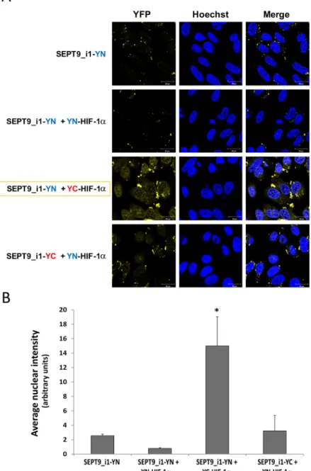 Figure 3: Optimal BiFC of split-YFP HIF-1α and SEPT9_i1 chimeras.  (A) PC-3 cells were seeded on glass-bottomed plates  and transiently transfected with the indicated split-YFP constructs, using 10-fold more HIF-1α constructs (1 µg) than that for SEPT9_i1 