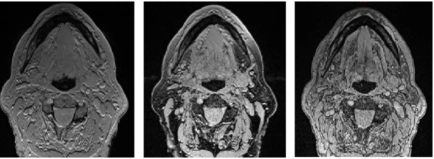 Table 3 Segmentation quality scoring of each 3D mandible model derived from the validation series 