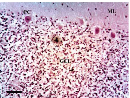 Fig. 2. Quantitative method of sampling the cer­ebellum hemisphere in multiple system atrophy (MSA) showing the 50 × 250 mm plots