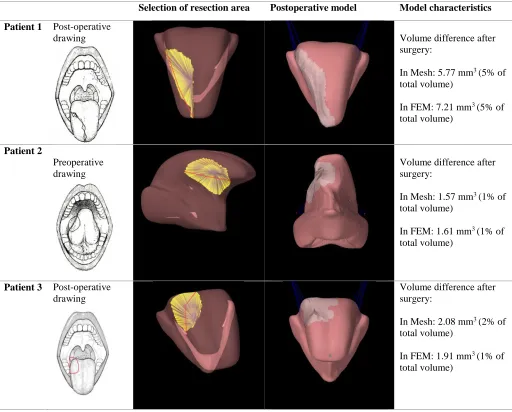 Table 4 Postoperative drawings, selection area, postoperative model and stats of three models based on patient cases