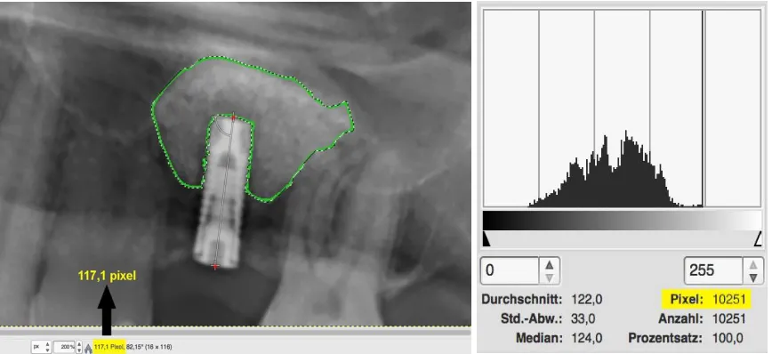 Figure 1 (a) Newly gained area framed and displayed in green. (b) The “histogram” tool showing the number of pixels (10,251) within the area bordered in green on the left side