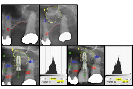 Table 1 Types and locations of implants used in this study  