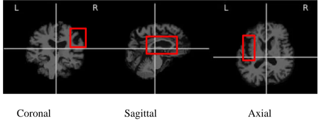 Figure 3.2 An example of localization task for brain lesions in Axial, hippocampus  detection in sagittal and lesion in coronal sections 