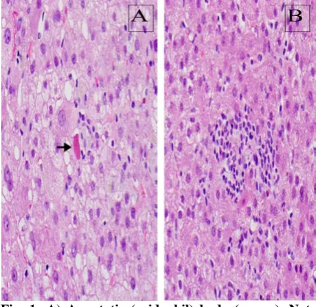 Table 1: Summary of morphological, molecular and biochemical features distinguishing hepatic apoptosis and necrosis