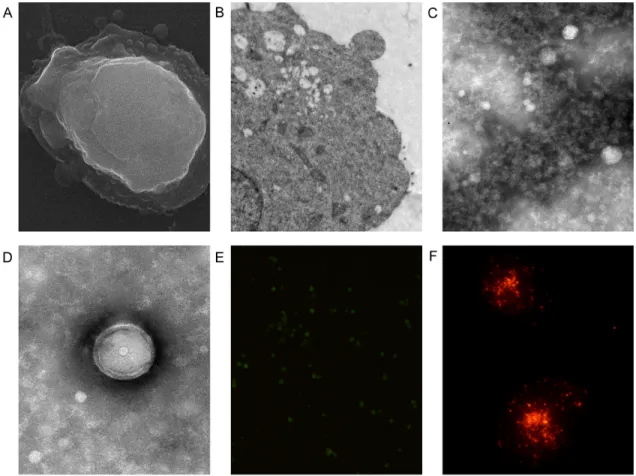 Figure  1:  Fluorescent  labeling  and  electron  microscopy  of  microvesicles  (MVs)