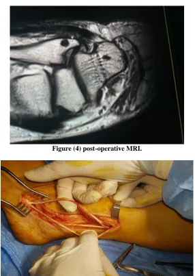 Figure (4) post-operative MRI. 