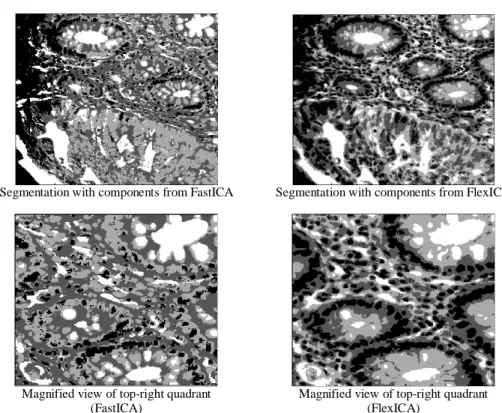 Figure 2: ICA based segmentation without preprocessing 