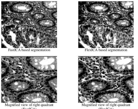 Figure 3: ICA based segmentation with preprocessing by high-emphasis filtering 