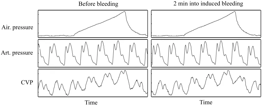 Figure 8: Four second samples of vital sign time series collected from one pig in pre-bleedphase (left) and 2 minutes into the induced bleeding (right)