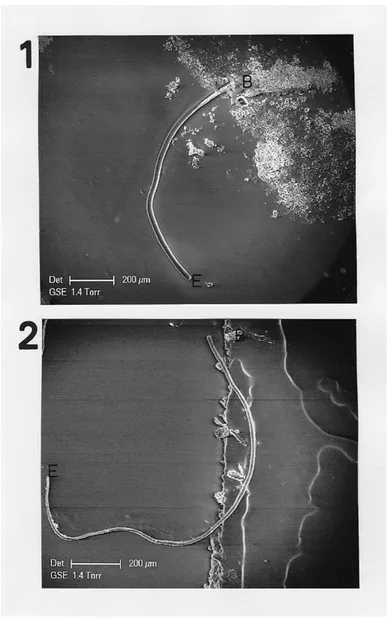Figure 3: Electron microscopy (in GSE, 100x) of EB1 and EB2.1: SEM photograph of EB1.2: SEM photograph of the entire part of EB2