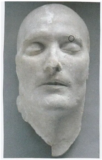 Figure 1  : The Antommarchi death-mask of Napoléon. The circle on the left eyebrow indicates the region where the sample was taken