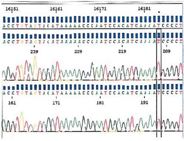 Figure 23 : HVS1 DNA sequence (from positions 16149 to 16189) of the EB2 mtDNA. A (in green) : adenine ; C (in blue) : cytosine ; G (in yellow) : guanine , T (in red) : thymine