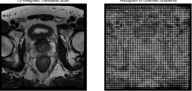 Figure 18a shows the visual output of histogram of oriented gradients, for a T2­weighted                             transaxial scan