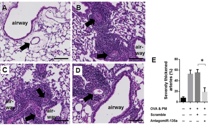 Figure 3: Decreased severe pulmonary arterial remodeling and thickness in AntagomiR-135a injected mice exposed  to OVA &amp; PM