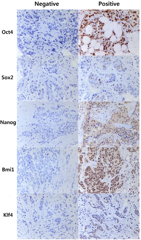 Figure 1: Representative images of immunohistochemal staining of embryonal stem cell transcription factors