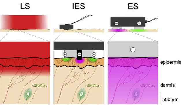 Figure 2.2: schematic overview different stimulation methods. Laser stimulation (LS),intra-epidermal electrical stimulation (IES) and transcutaneous electrical stimulation (ES)are represented