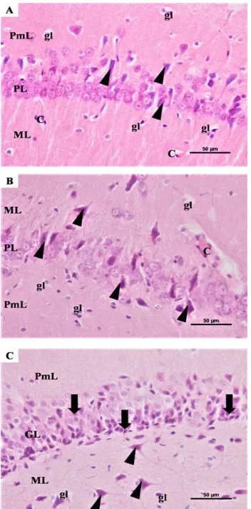 Fig. 9. Photomicrographs of the hippocampus from TQ/AD group: [A] Showing CA1 region 