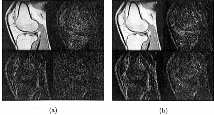 Figure 2.9: Two levels of a 20 Wavelet decomposition of one slice of the human knee MRI, (a) Level 1, (b) Level 2