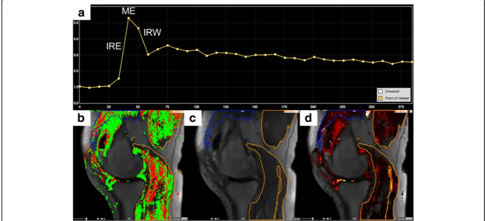 Fig. 1 DCE-MRI analysis. DCE-MRI analysis is based on changes in signal intensity over time for each voxel within the VOI