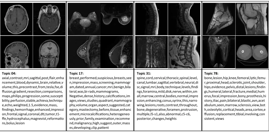 Figure 4: Examples of LDA generated document-level topics with corresponding images andkey words