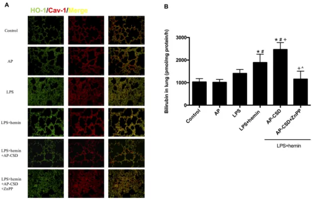 Figure 6: The pathology changes and biochemical indexes in LPS-induced mouse ALI.  A. Hematoxylin and eosin stained  lung sections (n = 5 each group)